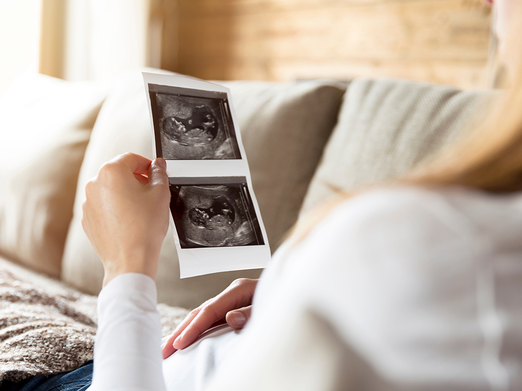 Pregnant woman expecting newborn and holding ultrasound while ly